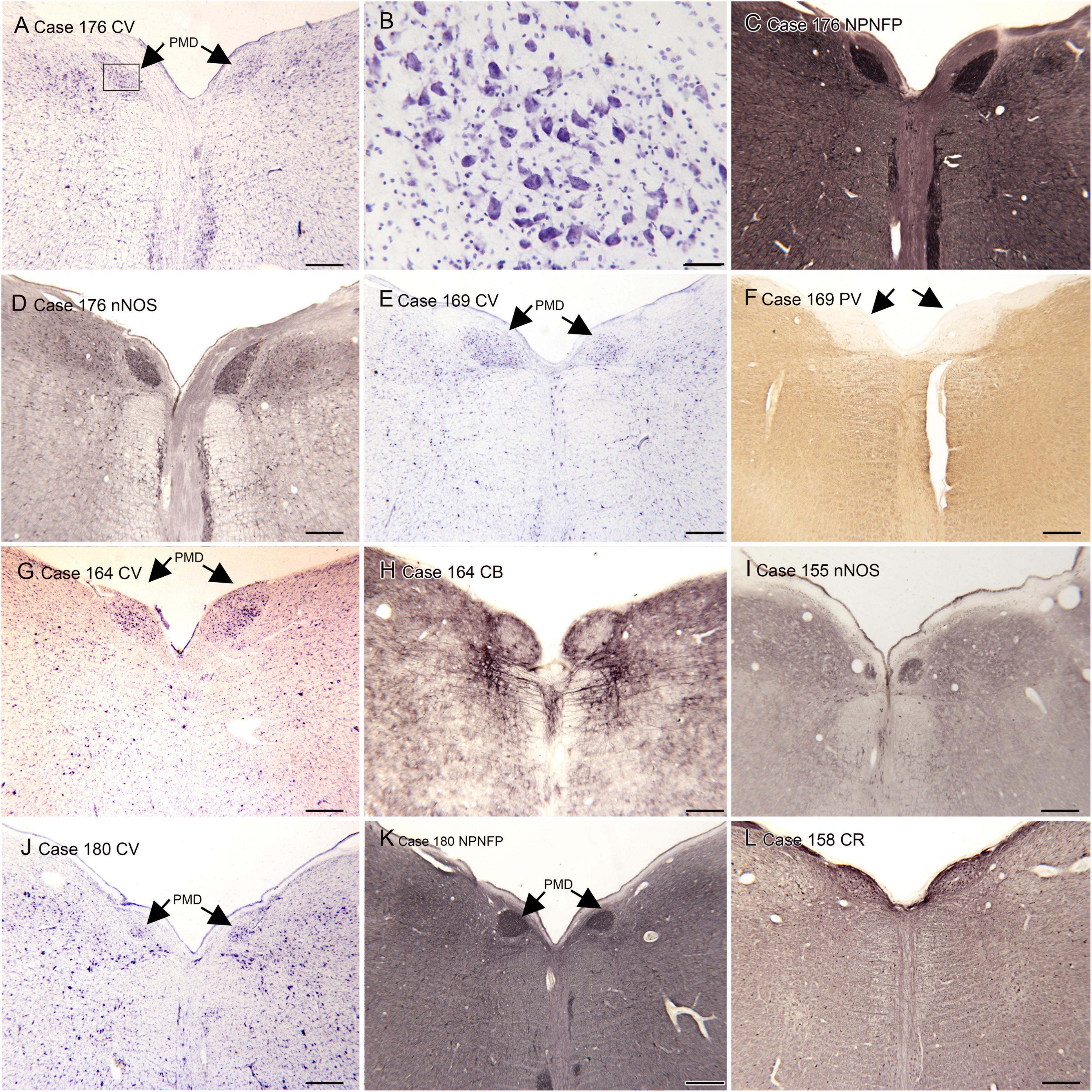 Comparative analysis of four nuclei in the human brainstem: Individual differences, left-right asymmetry, species differences